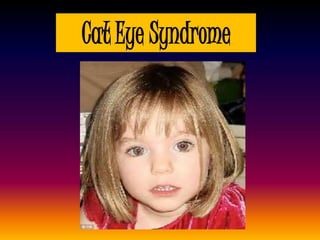 Cat Eye Syndrome
 