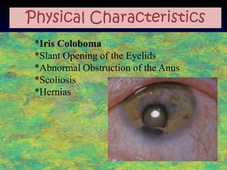 Physical Characteristics
 *Iris Coloboma
 *Slant Opening of the Eyelids
 *Abnormal Obstruction of the Anus
 *Scoliosis
 *Hernias
 
