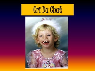Cri Du Chat
 