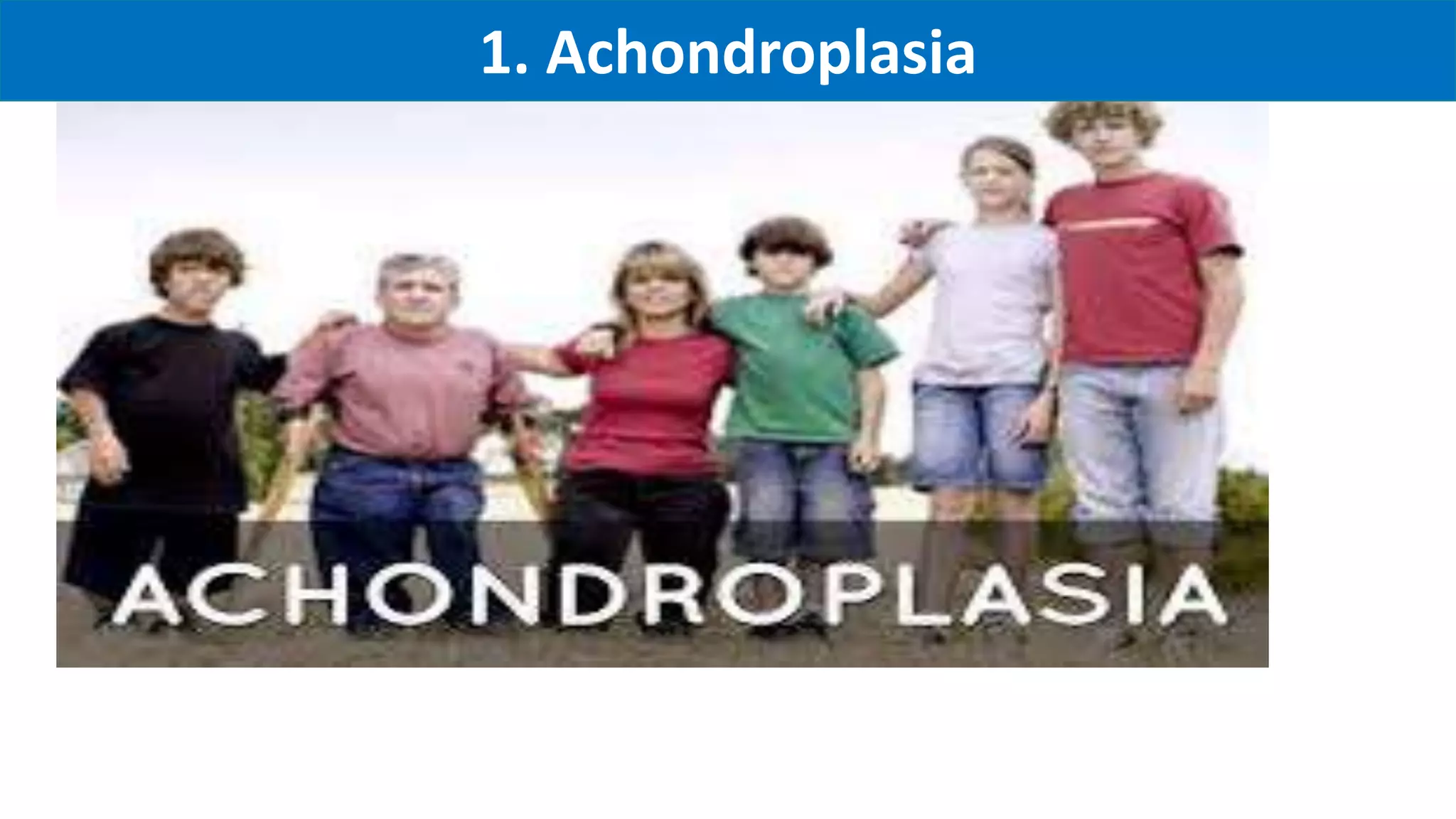 1. Achondroplasia
 