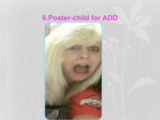 6.Poster-child for ADD
 