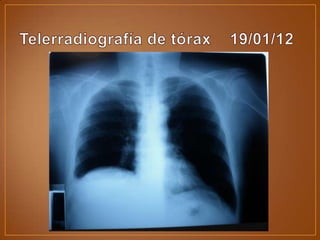 Auxiliares de diagnóstico