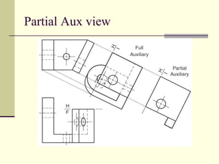 Partial Aux view
 