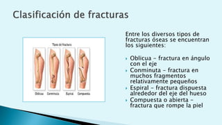 Entre los diversos tipos de
fracturas óseas se encuentran
los siguientes:
 Oblicua - fractura en ángulo
con el eje
 Conminuta - fractura en
muchos fragmentos
relativamente pequeños
 Espiral - fractura dispuesta
alrededor del eje del hueso
 Compuesta o abierta -
fractura que rompe la piel
 