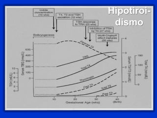 Hipotiroi-
dismo
 