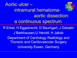Aortic ulcer –
intramural hematoma-
aortic dissection:
a continuous spectrum
R Erbel, H Eggebrecht, D Baumgart, J Debatin
J Barkhausen,U Herold, H Jakob
Department of Cardiology Radiology and
Thoracic and Cardiovascular Surgery
University Essen, Germany
 
