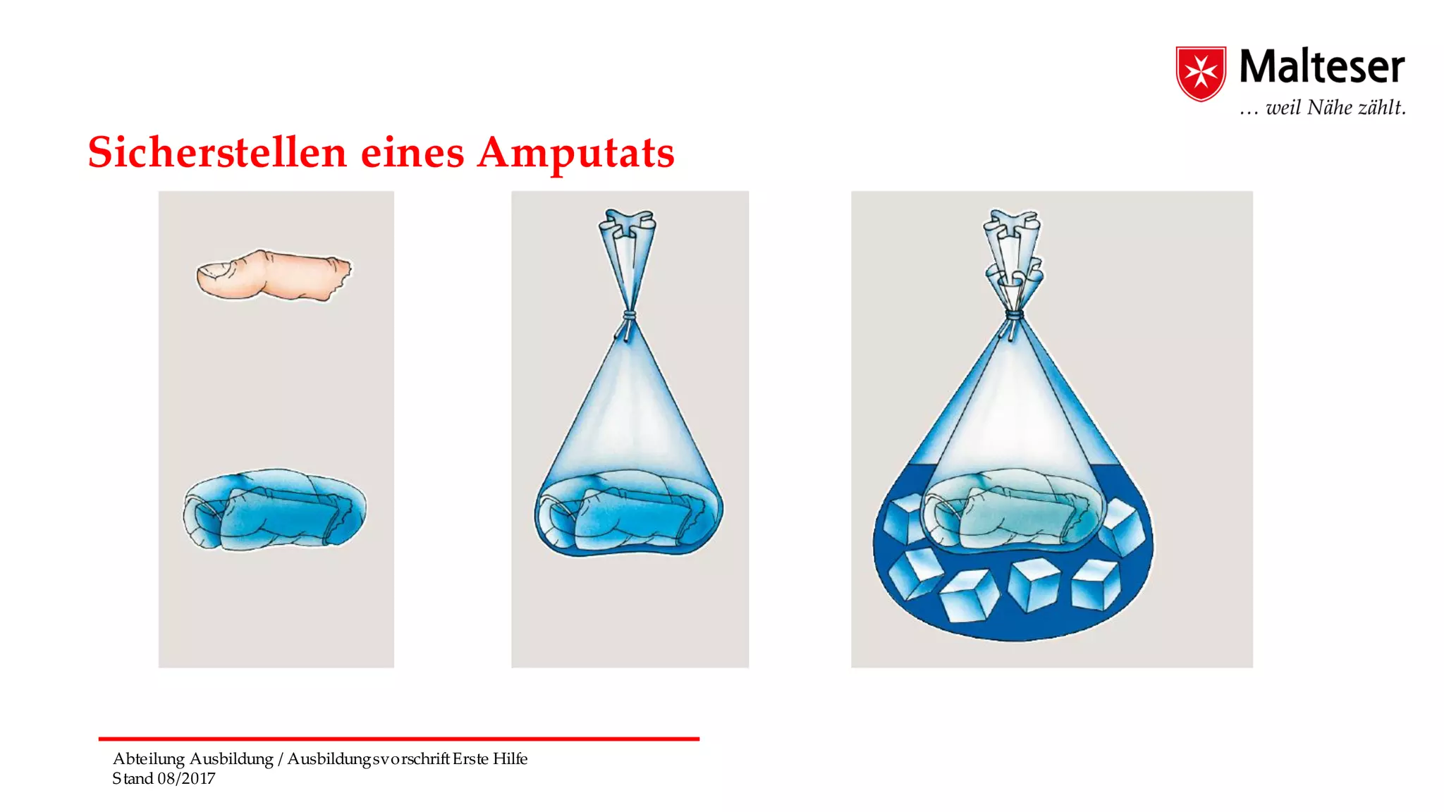 Abteilung Ausbildung / AusbildungsvorschriftErste Hilfe
Stand 08/2017
Sicherstellen eines Amputats
 