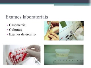 Exames laboratoriais
• Gasometria;
• Culturas;
• Exames de escarro.
 