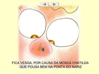 FICA VESGA, POR CAUSA DA MOSCA CHATILDA
QUE POUSA BEM NA PONTA DO NARIZ
 