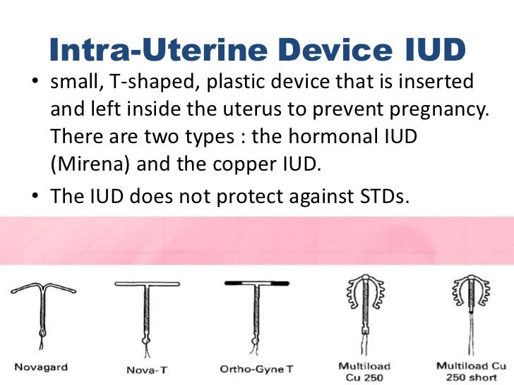 availability of family planning methods in sudan iud types