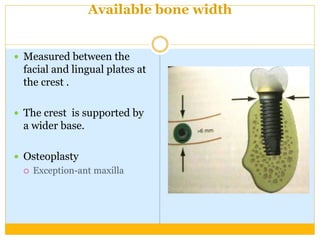Available bone width
 Measured between the
facial and lingual plates at
the crest .
 The crest is supported by
a wider base.
 Osteoplasty
 Exception-ant maxilla
 