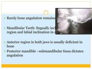  Rarely bone angulation remains ideal.
 Mandibular Teeth: lingually inclined in posterior
region and labial inclination in anterior region.
 Anterior region in both jaws is usually deficient in
bone
 Posterior mandible –submandibular fossa dictates
angulation
 