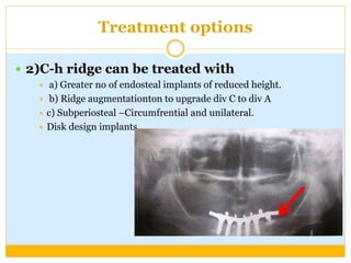 Treatment options
 2)C-h ridge can be treated with
 a) Greater no of endosteal implants of reduced height.
 b) Ridge augmentationton to upgrade div C to div A
 c) Subperiosteal –Circumfrential and unilateral.
 Disk design implants
 