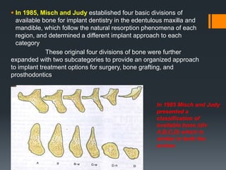 Available Bone and Dental Implant Treatment Plans.pptx