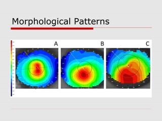Morphological Patterns
 