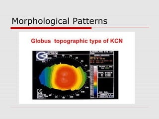 Morphological Patterns
 