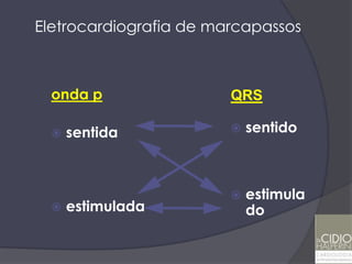 Eletrocardiografia de marcapassos



  onda p                QRS

     sentida              sentido



                           estimula
     estimulada            do
 