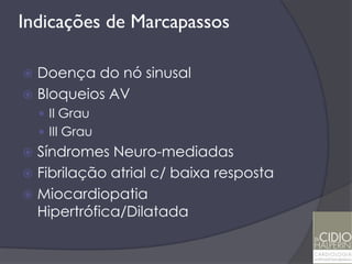Indicações de Marcapassos

 Doença do nó sinusal
 Bloqueios AV
     II Grau
     III Grau
 Síndromes Neuro-mediadas
 Fibrilação atrial c/ baixa resposta
 Miocardiopatia
  Hipertrófica/Dilatada
 