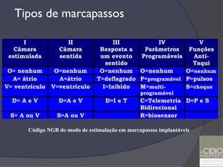 Tipos de marcapassos

      I              II              III           IV          V
   Câmara         Câmara         Resposta a   Parâmetros    Funções
 estimulada       sentida        um evento   Programáveis    Anti-
                                   sentido                   Taqui
 O= nenhum       O=nenhum        O=nenhum O=nenhum         O=nenhum
  A= átrio        A=átrio       T=deflagrado P=programável P=pulsos
V= ventrículo   V=ventrículo      I=Inibido  M=multi-      S=choque
                                                 programável
  D= A e V        D=A e V           D=I e T      C=Telemetria D=P e S
                                                 Bidirecional
 S= A ou V       S=A ou V                        R=biosensor

       Código NGB do modo de estimulação em marcapassos implantáveis
 