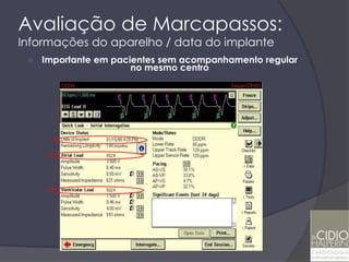 Avaliação de Marcapassos:
Informações do aparelho / data do implante
    Importante em pacientes sem acompanhamento regular
                       no mesmo centro
 