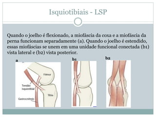 Isquiotibiais - LSP
Quando o joelho é flexionado, a miofáscia da coxa e a miofáscia da
perna funcionam separadamente (a). Quando o joelho é estendido,
essas miofáscias se unem em uma unidade funcional conectada (b1)
vista lateral e (b2) vista posterior.
b1a
b2
 