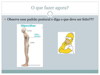 O que fazer agora?
 Observe esse padrão postural e diga o que deve ser feito???
 