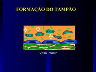 Vaso Intacto
FORMAÇÃO DO TAMPÃO
 