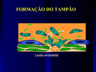 Lesão endotelial
FORMAÇÃO DO TAMPÃO
 