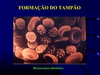 Microscopia eletrônica
FORMAÇÃO DO TAMPÃO
 