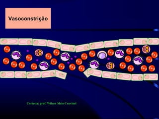 Vasoconstrição
Cortesia: prof. Wilson Melo Cruvinel
 