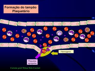 Plaquetas
agregadas
Fibrinogenio
Formação do tampão
Plaquetário
Cortesia: prof. Wilson Melo Cruvinel
 