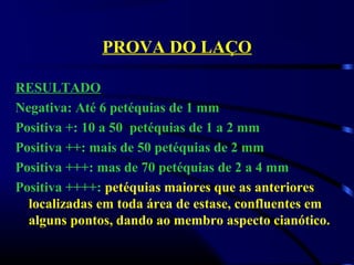 PROVA DO LAÇO
RESULTADO
Negativa: Até 6 petéquias de 1 mm
Positiva +: 10 a 50 petéquias de 1 a 2 mm
Positiva ++: mais de 50 petéquias de 2 mm
Positiva +++: mas de 70 petéquias de 2 a 4 mm
Positiva ++++: petéquias maiores que as anteriores
localizadas em toda área de estase, confluentes em
alguns pontos, dando ao membro aspecto cianótico.
 