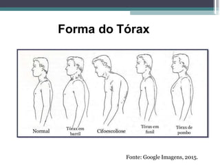 Fonte: Google Imagens, 2015.
Forma do Tórax
 