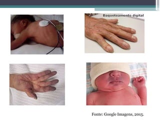 Fonte: Google Imagens, 2015.
 