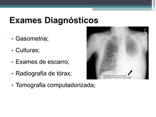 Exames Diagnósticos
• Gasometria;
• Culturas;
• Exames de escarro;
• Radiografia de tórax;
• Tomografia computadorizada;
 