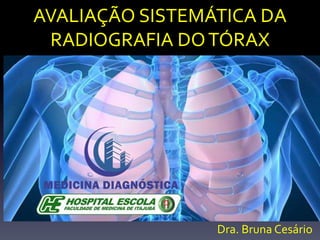 AVALIAÇÃO SISTEMÁTICA DA
RADIOGRAFIA DOTÓRAX
Dra. Bruna Cesário
 