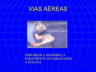 VIAS AÉREAS EMPURRAR A MANDÍBULA PARA FRENTE ESTABILIZANDO A COLUNA 