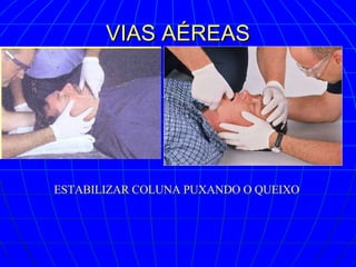 VIAS AÉREAS ESTABILIZAR COLUNA PUXANDO O QUEIXO 