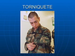 TORNIQUETE 