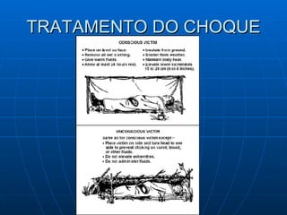 TRATAMENTO DO CHOQUE 