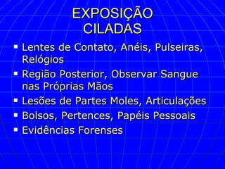 EXPOSIÇÃO CILADAS Lentes de Contato, Anéis, Pulseiras, Relógios Região Posterior, Observar Sangue nas Próprias Mãos Lesões de Partes Moles, Articulações Bolsos, Pertences, Papéis Pessoais Evidências Forenses 