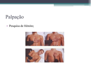 Palpação
• Pesquisa de frêmito;
 