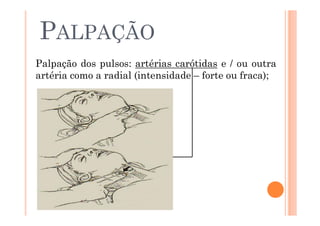 PALPAÇÃO
Palpação dos pulsos: artérias carótidas e / ou outra
artéria como a radial (intensidade – forte ou fraca);
 