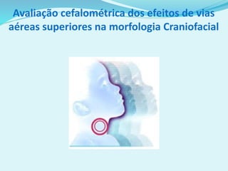 Avaliação cefalométrica dos efeitos de vias
aéreas superiores na morfologia Craniofacial
 