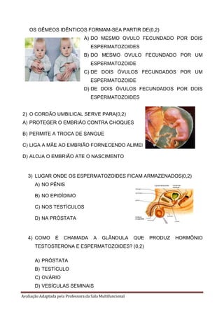 Avaliação Adaptada pela Professora da Sala Multifuncional
OS GÊMEOS IDÊNTICOS FORMAM-SEA PARTIR DE(0,2)
A) DO MESMO OVULO FECUNDADO POR DOIS
ESPERMATOZOIDES
B) DO MESMO OVULO FECUNDADO POR UM
ESPERMATOZOIDE
C) DE DOIS ÓVULOS FECUNDADOS POR UM
ESPERMATOZOIDE
D) DE DOIS ÓVULOS FECUNDADOS POR DOIS
ESPERMATOZOIDES
2) O CORDÃO UMBILICAL SERVE PARA(0,2)
A) PROTEGER O EMBRIÃO CONTRA CHOQUES
B) PERMITE A TROCA DE SANGUE
C) LIGA A MÃE AO EMBRIÃO FORNECENDO ALIMENTO E OXIGÊNIO
D) ALOJA O EMBRIÃO ATE O NASCIMENTO
3) LUGAR ONDE OS ESPERMATOZOIDES FICAM ARMAZENADOS(0,2)
A) NO PÊNIS
B) NO EPIDÍDIMO
C) NOS TESTÍCULOS
D) NA PRÓSTATA
4) COMO É CHAMADA A GLÂNDULA QUE PRODUZ HORMÔNIO
TESTOSTERONA E ESPERMATOZOIDES? (0,2)
A) PRÓSTATA
B) TESTÍCULO
C) OVÁRIO
D) VESÍCULAS SEMINAIS
 