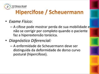 Fábio Mazzola
• Exame Físico:
– A cifose pode mostrar perda de sua mobilidade e
não se corrigir por completo quando o paciente
faz a hiperextensão torácica.
• Diagnóstico Diferencial:
– A enfermidade de Scheuermann deve ser
distinguida da deformidade de dorso curvo
postural (hipercifose).
 