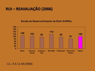 RUI – REAVALIAÇÃO (2006) 
Escala de Desenvolvimento de Ruth Griffiths 
108 102 95 
119 
95 
81 
100 
0 
20 
40 
60 
80 
100 
120 
140 
160 
180 
Motor Pessoal- 
Social 
Audição e 
Fala 
Olho-Mão Realização Raciocínio 
Prático 
Global 
I.C.: 4 A 11 M (59M) 
 