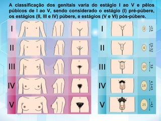 A classificação dos genitais varia do estágio I ao V e pêlos
púbicos de I ao V, sendo considerado o estágio (I) pré-púbere,
os estágios (II, III e IV) púbere, e estágios (V e VI) pós-púbere.
 