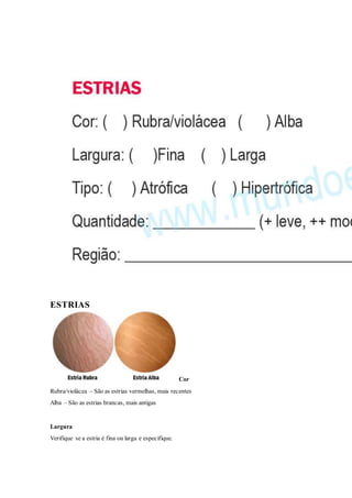 ESTRIAS
Cor
Rubra/violácea – São as estrias vermelhas, mais recentes
Alba – São as estrias brancas, mais antigas
Largura
Verifique se a estria é fina ou larga e especifique.
 