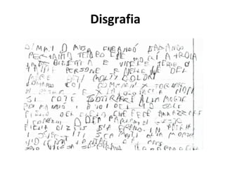 Disgrafia
 